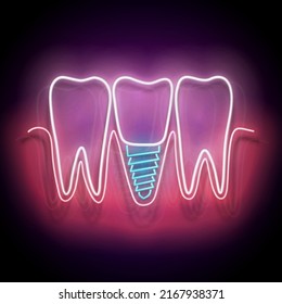 Glow Dentition with Implanted Tooth. Denture Concept Template. Neon Light Poster, Flyer, Banner, Signboard. Glossy Background. Vector 3d Illustration
