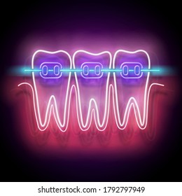 Glow Dentition with White Teeth and Braces. Orthodontic Clinic Concept Template. Neon Light Poster, Flyer, Banner, Signboard. Glossy Background. Vector 3d Illustration