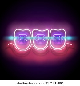 Glow Dentition with White Teeth and Braces. Orthodontic Clinic Concept Template. Neon Light Poster, Flyer, Banner, Signboard. Glossy Background. Vector 3d Illustration
