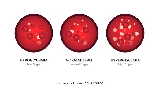 Glucose blood level sugar test. vector illustration