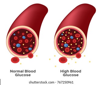glucose in blood vector