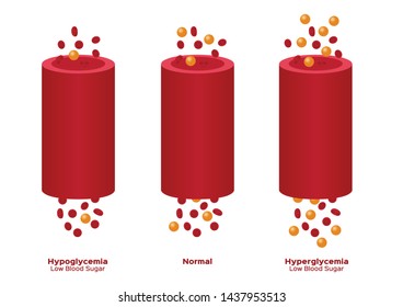 Glucose In Blood Vector / Hypoglycemia, Hyperglycemia