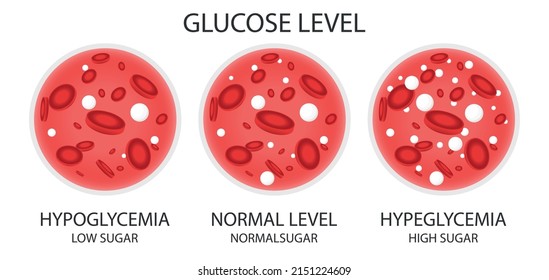 Glucose in the blood vessel: normal level, hyperglycemia, hypoglycemia. Medical vector illustration.