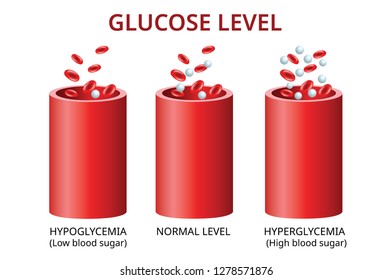 Glucose level in the blood vessel, normal level, hyperglycemia (high blood sugar), hypoglycemia (low blood sugar) Vector Illustration