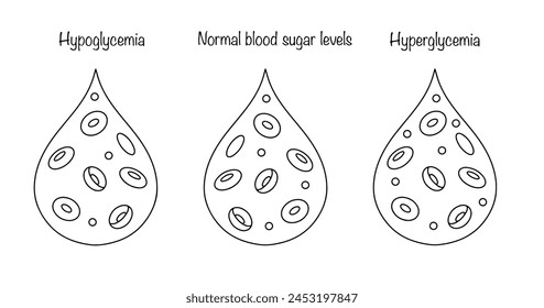 Glukosespiegel im menschlichen Blut. Glukosemangel, normal und exzessiv. Medizinische Illustration mit Linie. Vektorgrafik.