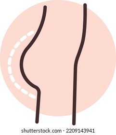 Gluteoplasty surgery, illustration, vector on white background.