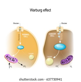 glycolysis. Warburg effect. Metabolism in the Normal cell and Cancer cell. Tumor cells have higher levels of glycolysis and lactate production