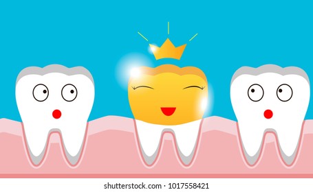 gold crown on tooth, inset, teeth, protection, prosthesis vector.