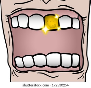 Gold tooth