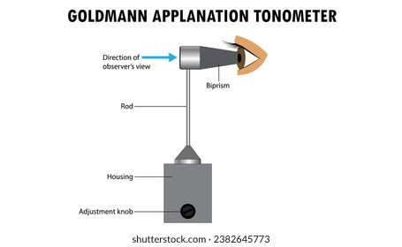 Goldemann Applanation Tonometer diagram, Instrument