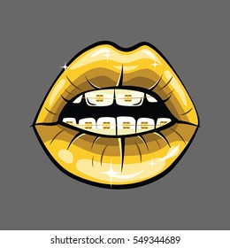 Golden Lips  with braces vector illustration isolated on grey background. Cartoon lipstick, shiny letters.