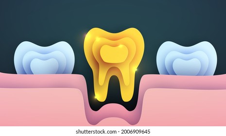 Golden tooth silhouette in modern creative style. Minimalistic luxury design concept. Premium healthcare medical composition art element. Bright paper cut layer vector illustration.