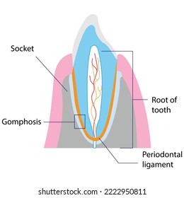 A Gomphosis is a specialized fibrous joint that anchors a tooth to its socket in the jaw