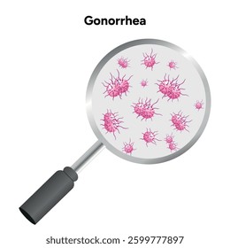 Gonorrhea. Human reproductive system transmitted infection virus bacterial