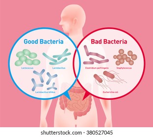 Good Bacteria And Bad Bacteria, Enteric Bacteria, Intestinal Flora, Gut Flora, Probiotics, Image Illustration