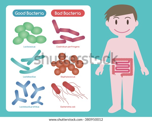 良菌と悪菌 腸内細菌 腸内細菌叢 腸内細菌 プロバイオティクス 画像イラスト のベクター画像素材 ロイヤリティフリー 380950012