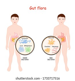 Good And Bad Bacteria. Gut Flora Of Children. Kids With Intestines And Different Forms Of Bacteria. Close-up Of Enteric Bacteria. Intestinal Flora With Probiotic. Vector Illustration