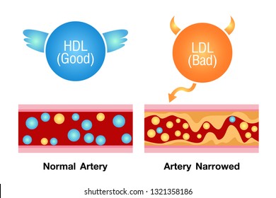 Good And Bad Cholesterol , Health Risk , Vector Design