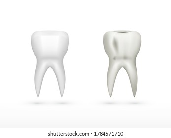 Good And Bad White Molar Tooth With Shadow. EPS10 Vector