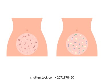 Good healthy and bad pain microflora in abdomen intestine. Digestion bowel. Female body figure with harmful and beneficial bacteria. Vector illustration