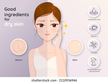 Good ingredients for dry skin