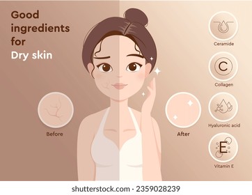 Good ingredients for dry skin