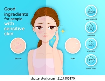 Good ingredients for people with sensitive skin