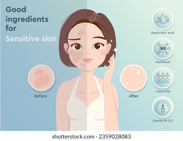 Good ingredients for people with sensitive skin