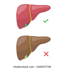 Good liver and liver cirrhosis vector design.