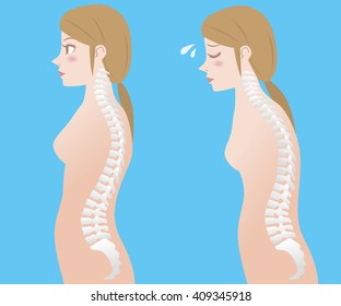 Good posture and bad posture, woman's body silhouette and backbone, chiropractic before after image, vector illustration