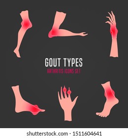 Gout arthritis icons set. Joint pain in human foot, leg, wrist, ankle, hand, arm. Editable vector illustration in pink and red colors isolated on grey background. Modern flat style. Graphic design