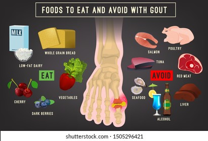 Gout arthritis infographic. Foods to eat and avoid. Joint pain in human foot. Editable vector illustration in bright colors isolated on grey background. Medicine, healthy lifestyle concept.