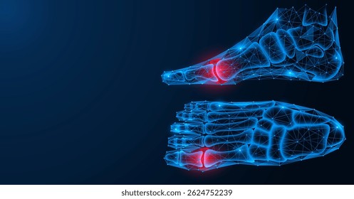 Gout, damage to the joints of the foot. Polygonal design of lines and dots. Blue background.