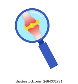 conceito de doença de gota. ilustração vetorial