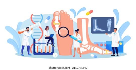 Gout Treatment. Arthritis Joint In The Ankle. Doctor Diagnoses Swollen And Inflamed Foot Joint. Physician Looking At X-ray Scan. Human Feet Bone With Uric Acid Crystals. Medical Appointment And Exam