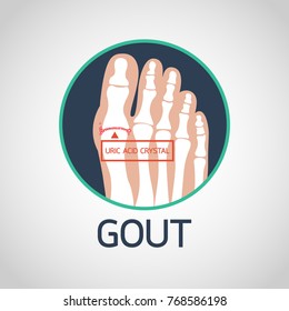 Gout vector logo icon illustration