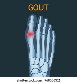 Gout Vector Logo Icon Illustration