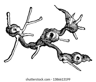 Grape Gall Louse Damage the small figures showing natural sizes, vintage line drawing or engraving illustration.