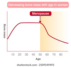 Gráfico de cambios en la masa ósea por edad en mujeres, y la relación entre la menopausia y la osteoporosis.