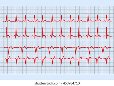 The graph electrocardiogram heart on paper form . Health concept. Vector illustration.