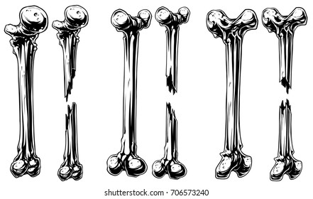 Graphic black and white different broken human bone vector set. Vol. 2