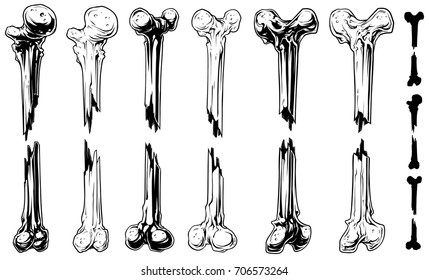 Graphic black and white different broken human bone vector set. Vol. 1