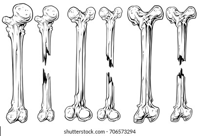 Graphic black and white different broken human bone vector set. Vol. 3