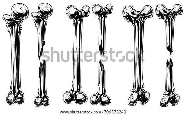 Graphic Black White Different Broken Human Stock Vector (Royalty Free ...