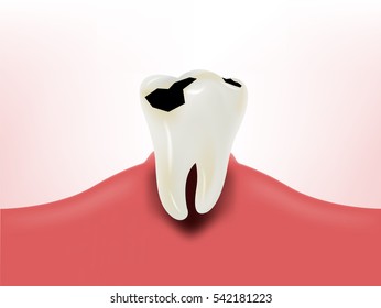 graphic design of bacteria eating tooth on gum, dental health design concept, decayed tooth