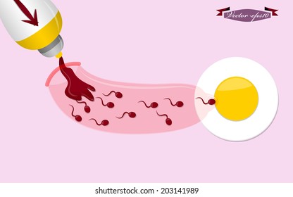 graphic design illustration vector of condom, family planning design concept