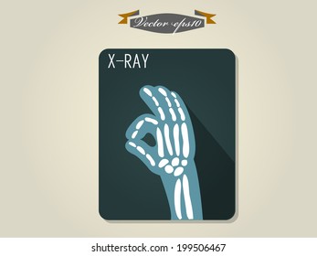 graphic design vector of x ray film of hand