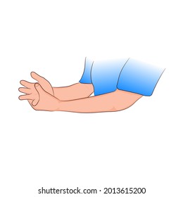 graphics drawing concept Guillain-Barre syndrome Wrist pain is often caused or ascending para