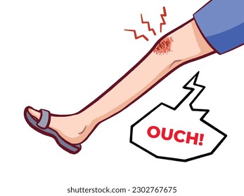 Grazed or wounded and bleeding knee leg vector illustration isolated on horizontal white background. Hurt leg from falling or sport accidents with simple flat art style.