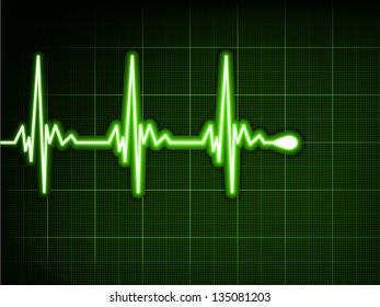 Green heart beat. Ekg graph. EPS 8 vector file included